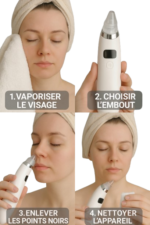 Extracteur de point noir pour visage – Image 2