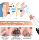 Aspirateur de point noir pour visage – Image 4