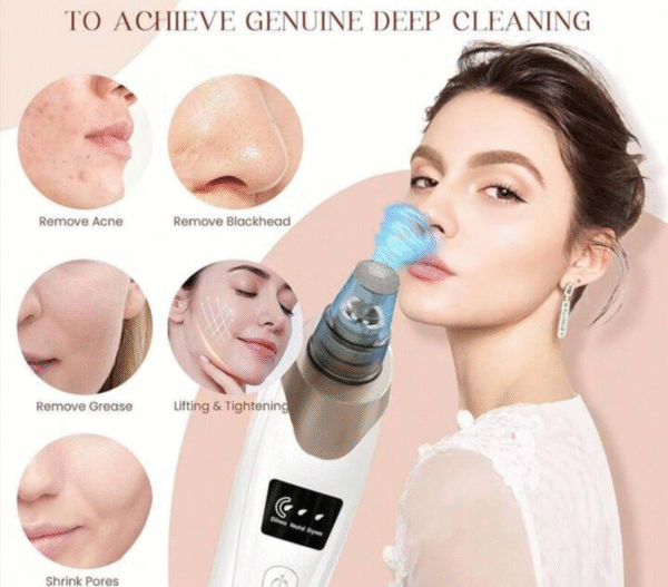 Extracteur de point noir pour visage – Image 3