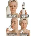 Extracteur de point noir pour visage – Image 2